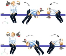 The Bascule/Pendular maneuver performed in the LARP and RALP.