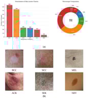 PAD-UFES-20 dataset overview. (a) Class distribution showing severe imbalance. (b) Representative samples from each class.