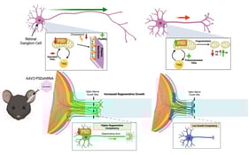 PSD upregulation in human glaucomatous optic nerves. (A) Total phospholipid levels between normal and glaucomatous human optic nerves. (B) Bar graph of PE acyl- and plasmalogen-based lipid species from glaucomatous and control human optic nerves. p value shown after two-way ANOVA comparing within linkage groups. (C) Activity analysis of phospholipid metabolic enzymes from control and glaucomatous optic nerves (pmol product/min/mg). N = 12 biological replicates/group. t-test Analysis: * p < 0.05 (D) Western Blot of normal and glaucomatous human optic nerve samples with matched age and sex. Corresponding WB quantification (PSD/GAPDH) showing increased PSD Expression with GAPDH Control Band. The original Western Blot images can be found at the Supplementary Materials Figure S11.