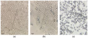 Optical microscopy images of representative HEWL polycrystalline samples: (a) Series 3, (b) Series 4 and (c) Series 5.