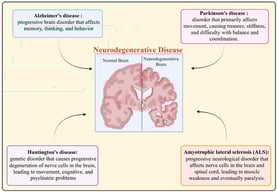 Overview of neurodegenerative diseases.