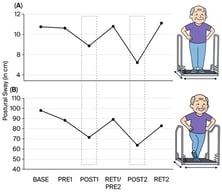 Changes in balance performance on the Posturomed. (A) indicates changes in postural sway measured in the bipedal stance on the free-swinging platform (i.e., Posturomed), whereas (B) displays the added sway path of the left and right single-leg stance on the Posturomed. It can be seen that after the balance learning interventions, the sway path was reduced (grey boxes). However, detraining always resulted in reduced performance, resulting in values close to baseline values for both (A) and (B).