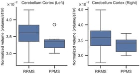 Cerebellum cortex volume normalized by estimated Total Intracranial Volume (eTIV) in patients with relapsing-remitting (RRMS) and primary progressive multiple sclerosis (PPMS).