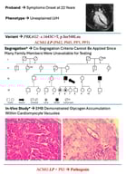Clinical, genetic, and histological characterization of the proband with PRKAG2 variant. The cardiac magnetic resonance imaging of the proband shows a 4-chamber view with mild left ventricular hypertrophy in the absence of secondary causes. * The family pedigree illustrates the inheritance pattern of the PRKAG2 c.1643C>T (p.Ser548Leu) variant. The proband is indicated by an arrow. Filled symbols denote individuals affected with the phenotype, half-filled symbols represent heterozygous carriers of the PRKAG2 variant, and a diagonal line indicates deceased individuals. “WT” indicates wild-type genotype; “SD” indicates sudden death. Genotype and phenotype data were not available for all family members (indicated with “?”). ° Histological evaluation of endomyocardial biopsy (EMB) specimens from the proband. Left: Haematoxylin-eosin staining (400×, scale bar 20 μm) showing hypertrophied myocytes. Right: Periodic acid–Schiff (PAS) staining (400×, scale bar 20 μm), positive for glycogen within cardiomyocyte vacuoles. Abbreviations: LP, likely pathogenic.