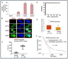 The expression of SATB2 in Met5A, and mesothelioma cell lines. (A), Expression of SATB2 mRNA in human normal mesothelial Met5A cells and mesothelioma cell lines. RNA was isolated, and qRT-PCR was used to measure SATB2 expression. *, #, and % = significantly different from Met5A (p < 0.05). (B), SATB2 expression by immunocytochemistry. Mesothelial and mesothelioma Met5A, H2714, H2452, and H2595 cells were grown in coverslips, fixed, and stained with anti-SATB2 antibody (Abcam, 1:500 dilution) for 24 h at 4 °C. Cells were then stained with secondary antibody and DAPI. Coverslips were mounted on the glass slides and imaged using a fluorescence microscope (Nikon). Green color = SATB2, Blue color = Nuclei. (C), H-Score of SATB2 protein expression in human normal mesothelial and mesothelioma tissues. Data represent mean (n = 40) ± SD. * = significantly different from normal (p < 0.001). (D), ROC Curve. ROC curve of normal and mesothelioma tissues. (E), SATB2 expression between males and females. TCGA data show a significant difference in SATB2 mRNA expression between samples from male (n = 71) and female (n = 16) mesothelioma patients (https://ualcan.path.uab.edu). Data represent mean ± SD. * = significantly different between males and females (p < 0.01). (F), TCGA data showing the effects of SATB2 expression on the survival probability curve of MPM patients expressing high and low/medium SATB2 levels. * = significantly different between the survival probability of MPM patients expressing high (n = 22) and low/medium (n = 63) SATB2 level (p < 0.05).