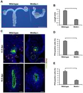 Phenotype of the Wnt5a-/- reproductive tract. (A) Gross morphology of reproductive tracts shows reduced length of uterine horns and vaginal agenesis in Wnt5a-/- mice compared to controls. (B) Measurement of the uterine horn length at 18.5 dpc. n = 5. (C) Immunofluorescence staining of proliferation marker PH3 (red) in samples at 13.5 and 18.5 dpc. At 13.5 dpc, epithelial marker CDH1 (green) stains the Wolffian ducts only; the Müllerian ducts are delineated with dashed lines. At 18.5 dpc, only the Müllerian ducts are present and are positive for CDH1. (D,E) Quantification of PH3-positive cells in 13.5 (D) and 18.5 dpc (E) samples. n = 3. Scale bars = 2mm (A) and 40mm (C). ** p < 0.01.