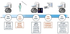 Medical course. Timeline of diagnosis and treatment of the patient with PRNET. Abbreviations: CT = Computed Tomography, Gy = Gray, SSTR PET/CT = Somatostatin Receptor Positron Emission Tomography/Computed Tomography, T8 = Thoracic Vertebra 8. This figure was created using BioRender.com.