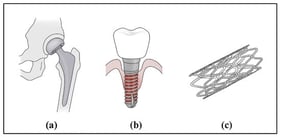 Representative biomedical applications of titanium alloys. (a) Hip implant. (b) Dental screw. (c) Stent.