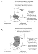 Pathophysiological mechanisms and acid secretion patterns in (A) antrum-predominant gastritis and (B) pangastritis. In antrum-predominant gastritis, inflammation inhibits D-cells, resulting in decreased somatostatin secretion, increased gastrin release from G-cells, and stimulation of parietal cells leading to increased gastric acid output and elevated risk of duodenal ulceration. In pangastritis, corpus inflammation suppresses parietal cell function, resulting in reduced acid secretion, hypergastrinemia, progression to gastric atrophy, and increased risk of gastric ulceration and adenocarcinoma.