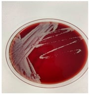 Colony morphology of Mycobacterium fortuitum on blood agar after incubation at 37 °C for three days, showing pale, opaque colonies that developed a yellowish coloration upon prolonged incubation.