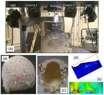 An example of a holistic approach involving the creation of both a physical model and an in silico (computational) model of a human skull, as studied in [15,16]. (A) A number of replicas of the skull were impacted at the same point in a drop tower, suitable illumination and high speed cameras were used, full details in [15,16]; (B) crack patterns at the site of impact were emanating in 3 diverging crack routes, which were identical in all replicas of the skull used [15]; (C) other cracks at the base of the skull (red square) appeared reliably and repeatedly in certain areas and where FEA modelling predicted them to appear (enlarged views of the area in (D,E)), showing a synergy and agreement between these two powerful biomechanical testing methodologies (AM produced physical model and in silico computational model).
