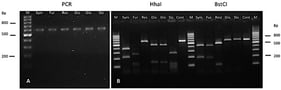 PCR and restriction fragment length polymorphism (RFLP) analysis of Malassezia reference strains were performed to compare them with the clinical isolates included in this study.; (A) PCR product; (B) Digestion products of reference strains treated with HhaI and BstCI enzymes. M: 100 bp molecular weight marker. Restriction patterns: Sym, M. sympodialis (400 and 220 bp); Fur, M. furfur (250 and 120 bp); Res, M. restricta (600 bp, undigested); Glo, M. globosa (450 and 130 bp); Slo, M. slooffiae (250, 110, and 80 bp); Cont: Undigested PCR product control.