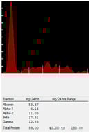 Urine protein electrophoresis with a glomerular pattern. Albumin is the major peak at the left.