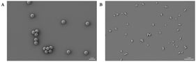 Scanning microscopy image of polystyrene. (A): PS1 μm, (B): PS100 nm; for both particles, size and dimension were confirmed. Scale bars: 2 µm (A); 1 µm (B).