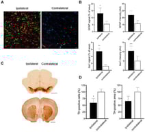 Inflammatory state in the Substantia Nigra pars compacta (SNpc) three days after 6-hydroxydopamine (6-OHDA) administration. (A) Representative images of glial fibrillary acidic protein (GFAP) and ionized calcium-binding adapter molecule 1 (Iba1) immunostaining in the SNpc ipsilateral (left panel) and contralateral (right panel) to the 6-OHDA administration. Green: GFAP; red: Iba1; blue: nuclei stained with Hoechst 33258. Scale bar: 20 µm. (B) Quantification of the area covered and signal intensity (AU, arbitrary units) of GFAP and Iba1 staining in the ipsilateral and contralateral SNpc (n = 4 per group). (C) Representative images of tyrosine hydroxylase (TH) immunostaining in the SNpc and striatum after 6-OHDA administration. Scale bar: 2 mm. (D) Quantification of the number of TH-positive neurons in the SNpc (left) and the area covered by TH signal in the striatum (right) (n = 4 per group). Data are expressed as mean ± standard error of the mean (SEM). * p < 0.05, ** p < 0.01, *** p < 0.001 vs. contralateral.