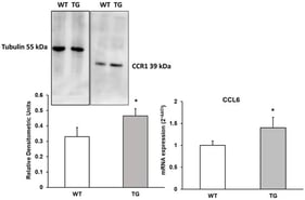 Protein expression of CCR1 and mRNA expression of CCL6 in the cortex of transgenic (TG) and wild-type (WT) mice. Data are presented as relative densitometric units (Western blot) and relative mRNA expression (2−ΔΔCt). Values represent the mean ± SD of five independent biological replicates (n = 5 per group), with each data point corresponding to the average of technical replicates. * p < 0.05 vs. WT.