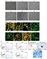 Characterization of human umbilical cord-derived mesenchymal stem cells. (A) Representative images of the homogeneous population of cells showing spindle-like morphology from P1 to P6. (B) Isolated cells positively expressed MSC-specific markers, including CD105, vimentin, CD117, CD29, Lin28, and Stro1. CD45 and HLA-DR, as hematopoietic and immunity markers, were not expressed. Alexa Fluor 488 and DAPI were used to stain the cytoskeleton and nuclei of cells, respectively. (C) Illustration of the phenotypic assessment of hUC-MSCs positive for vimentin, CD90, and CD105 and negative for CD45. (D) Tri-lineage differentiation assay shows successful production of calcium deposits, proteoglycans, and oil droplets by osteocytes, chondrocytes, and adipocytes, respectively. Images were captured using a microscope at 10× magnification.