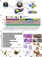 (A) schematic overview of biobanking process. (B). Sample overview with patient identifier and metadata (age, sex, and time of procurement). P indicates primary sample usually at time of diagnosis, R indicates samples from resection or recurrence. Tumour samples are marked T, and tumoroid samples are marked O. Sex is shown by M(ale) or F(emale), and age in years. WGS data is shown in green. (C). Graph showing the time in culture and number of passages for each tumoroid line. (D). Representative brightfield images of hepatoblastoma tumoroid cultures. (E). H&amp;E stain (left) and β-catenin stain (right) of tumour tissue (top panels) and tumoroid lines (bottom panels).