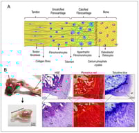 (A) Diagrammatic representation of tendon-to-bone enthesis; (B) rat Achilles enthesis stained by H&amp;E, Picrosirius red and Toluidine blue showing cellular and extracellular matrix components of four distinct zones: tendon, uncalcified fibrocartilage, calcified fibrocartilage and bone. Abbr. m: muscle; t: tendon, b: bone; BM: bone marrow of calcaneal bone, SB: subchondral bone, CF: calcified fibrocartilage, UF: uncalcified fibrocartilage, TM: tidemark, AT: Achilles tendon. Figures were independently created and recorded by the authors.