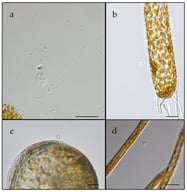(a) A HNAN cell at 60× (n = 1) from the original inoculation culture, (b) Odontella sp., (c) Cosinodiscus sp., and (d) Rhizosolenia sp. cultures on day 6 with an attached (n = 1) HNAN. The scale bars indicate 10 µm.