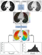 A diagram illustrating the process for computing divergence from the vector field of registered volumetric CT images at various respiration phases. DiVH: divergence volume histogram, DiH: divergence distribution histogram, DiM: divergence map.