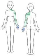 Body chart of the patient’s motor symptoms. Note: Blue lines represent tremor; green lines represent stiffness.