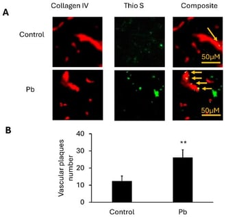 Vascular-associated Aβ deposition in APP/PS1 mice exposed to Pb. (A) Representative cortical sections from APP/PS1 mice illustrating collagen IV immunoreactivity (red) and thioflavin S–positive amyloid deposits (green). The merged image (orange) highlights regions where vascular and amyloid signals overlap. Arrowheads denote amyloid localized along blood vessels. (Scale bar: 50 μm.) (B) Quantification of vessel-associated amyloid deposition in brain sections from 16-week-old APP/PS1 mice treated with PbAc or NaAc. n = 5 mice per group. Data are presented as mean ± SD; **: p < 0.01, analyzed by one-way ANOVA followed by Dunnett’s post hoc test. Note: Control: sodium acetate-treated group, Pb: lead acetate-treated group, Thio S: thioflavin S.
