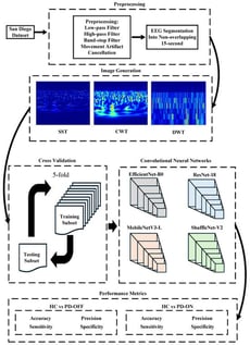 Workflow of the proposed EEG-based model for detecting Parkinson’s disease.