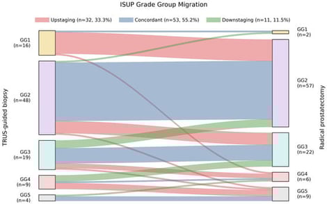 ISUP grade group migration between biopsy and radical prostatectomy. Sankey diagram illustrating transitions between ISUP grade groups at biopsy (left) and radical prostatectomy (right) in the full cohort (n = 96). Flow widths are proportional to patient counts. Concordant grading is shown in blue, upgrading in red, and downgrading in green. The diagram highlights the high frequency of upgrading among biopsy ISUP Grade Group 1 cases and the bidirectional instability observed in intermediate and high-grade groups.