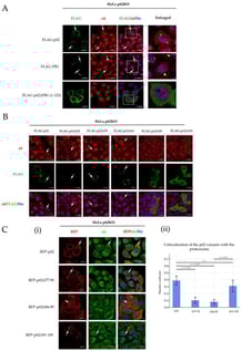 Mapping of the PIR domain. (A) Immunofluorescence images of HeLa p62KO cells transfected with FLAG-tagged constructs: p62-PB1 (1–115), p62WT, and p62ΔPB1 (∆1–123). Cells were co-stained with antibodies against FLAG (green) and the proteasome α6 subunit (red). Scale bars: 20 μm. (B) Immunofluorescence images of HeLa p62KO cells expressing N-terminal deletion variants (Figure S1) of p62. Cells were co-stained for FLAG (green) and the proteasome α6 subunit (red). Scale bars: 30 μm. (C) (i) Immunofluorescence images of HeLa p62KO cells expressing RFP-tagged PB1 internal deletion variants. Cells were immunostained for the proteasome α6 subunit (green). Scale bars: 40 μm. (ii) Quantitative colocalization analysis between p62 variants and the proteasome. In all panels, arrows point to p62 foci.