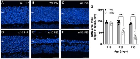 Histological analysis of retina from WT and rd10 mice during development shows loss of the photoreceptors in the outer nuclear layer (ONL) of rd10 mice by postnatal day 22. Representative images of central transverse retina from WT at (A) P17, (B) P22, and (C) P35 in comparison to rd10 at (D) P17, (E) P22 and (F) 35 labelled for cell nuclei using (Bisbenzimide, blue) and imaged using confocal microscopy. (G) Quantitative analysis of ONL area per length of central retina shows that at P17, the thickness of ONL is similar between WT and rd10. At P22 and P35 there is significant loss of ONL in rd10 mice relative to age matched WT controls (p < 0.01). Data are expressed as mean ± SEM for n = 6 mice at each age. Data were analysed using a two-way ANOVA and post hoc between WT and rd10 with significance shown, n = 6, ** p < 0.01.