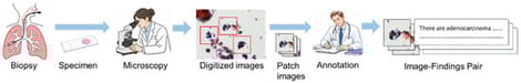 Workflow of dataset construction for cytological image–finding pairs. Red rectangles indicate the selected patch regions used for analysis.