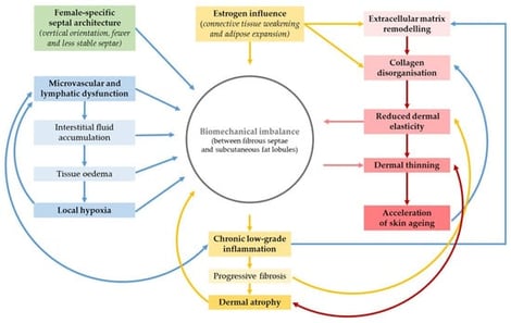 Schematic representation of the key biomechanical, hormonal, vascular, inflammatory, and extracellular matrix (ECM) mechanisms contributing to cellulite development and progression. Female-specific vertical septal architecture, oestrogen-mediated connective-tissue weakening, and adipose expansion create a structural imbalance between fibrous septae and subcutaneous fat lobules. Microvascular and lymphatic dysfunction promote interstitial fluid accumulation, oedema, and local hypoxia, leading to chronic low-grade inflammation. Progressive ECM remodelling, collagen disorganisation, reduced dermal elasticity, and dermal thinning collectively accelerate skin ageing and fibrosis, resulting in the characteristic surface irregularities observed in cellulite.