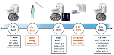 Medical course. Timeline of diagnosis and treatment of the patient with PRNET. Abbreviations: CT = Computed Tomography, Gy = Gray, SSTR PET/CT = Somatostatin Receptor Positron Emission Tomography/Computed Tomography, T8 = Thoracic Vertebra 8. This figure was created using BioRender.com.