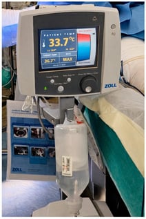 ThermogardXP® Zoll® console in theatre, showing patient’s core temperature of 33.7 °C.