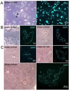 Lampbrush chromosomes (LBCs) in Rana temporaria oocytes. (A) LBCs isolated from stage 4 oocytes in the period of fast growth in summer. The arrows point to marker loops on one of the LBCs. (B,C) LBCs isolated from stage 4 oocytes during winter hibernation. LBCs were isolated either at room temperature (B) or on ice (C).