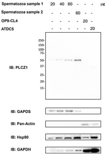 Primary antibody specificity control. Western blot analysis of PLCζ1 expression. Total proteins were extracted from two human samples, OP9-DL4 and ATDC5 cell lines (from left to right). Western blotting was performed with 20–60 μg of proteins. PLCζ1 (top panel), GAPDS (second panel), Pan-Actin (third panel), Hsp90 (fourth panel), and GAPDH (last panel) were revealed as described in the Section 2. (The original Western blot membranes corresponding to Figure 1 are provided in the Supplementary Materials (Supplementary Figures S1–S5)).