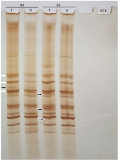 AP-PCR DNA profiles of glial tumor (T) and normal tissue (blood) (N) obtained with Ca12F primer. The numbers 94 and 95 indicate the serial number of the patients. Black arrows point to MIN and white arrows point to CIN; NTC—no-template control.