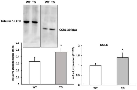 Protein expression of CCR1 and mRNA expression of CCL6 in the cortex of transgenic (TG) and wild-type (WT) mice. Data are presented as relative densitometric units (Western blot) and relative mRNA expression (2−ΔΔCt). Values represent the mean ± SD of five independent biological replicates (n = 5 per group), with each data point corresponding to the average of technical replicates. * p < 0.05 vs. WT.