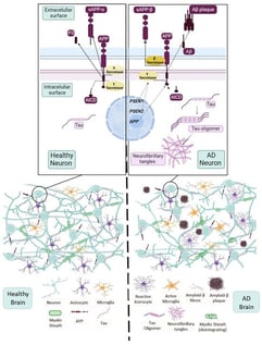 Neuropathological findings and cellular alterations in the AD brain. Schematic representation of the main pathological features in AD brain (right) compared to healthy brain (left): accumulation of amyloid plaques (Aβ), neurofibrillary tangles (NFTs) of phosphorylated Tau, demyelination, dendritic loss, microgliosis, and reactive astrogliosis. Upper right panel: scheme of the amyloidogenic processing of APP through the β-secretase pathway and the role of PSEN1 and PSEN2 proteins as catalytic subunits of γ-secretase in familial AD. Figure created with BioRender.com.