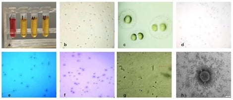 Isolation and morphological characterization of Mycoplasma bovis; (a) Growth observation in liquid culture medium; (b) Results of solid medium (×100); (c) Results of solid medium (×400); (d) Gram-staining results of colonies (×100); (e) Dienes-staining results of colonies (×100); (f) Giemsa-staining results of colonies (×100); (g) Giemsa-staining results of bacteria (×1000), as indicated by the red arrow; (h) Electron microscope observation of Mycoplasma bovis isolated (×150,000).