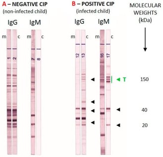 On the left, an example of comparative Western blot in a non-congenital infection. On the right, an example of congenital toxoplasmosis diagnosed by comparative Western blot; arrows indicate additional bands present in the newborn’s serum. A classic IgM pattern is a triplet of bands at 75, 90, and 100 kDa (see green “T” in the image); m, mother; c, child. Image taken from the test kit’s Instructions for Use [12].
