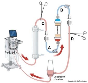 In-line connection and disconnection of the Toraymyxin® PMX-20R cartridge to the ongoing CRRT circuit. After priming, the cartridge had an inlet (male, “A”) and outlet (female, “B”), both clamped. The CRRT circuit was paused, and tubing clamped after the hemofilter (“C”) and before the air chamber (“D”). The segment between clamps was disconnected, and the cartridge was integrated in-line by connecting “A” to “C” and “B” to “D.” Clamps were removed, and CRRT resumed. For disconnection, the circuit was paused, tubing clamped at points “A,” “B,” “C,” and “D,” connections “A–C” and “B–D” released, the cartridge discarded with “A” and “B” attached, and the original CRRT circuit re-established. Red arrows show the direction of blood flow through the circuit.