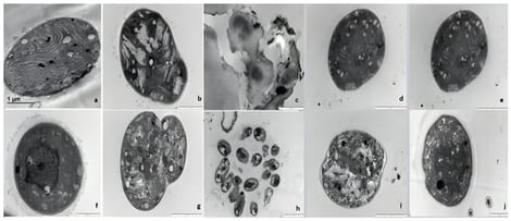 Transmission electron micrographs of Microcystis sp. exposed to four bacterial isolates after 4 days. Unexposed Microcystis (a,f) Microcystis exposed to isolate 1 (Aeromonas lacus) (b) and heat-treated isolate 1 (g), isolate 3w (Pseudomonas rhodesiae) (c) and heat-treated isolate 3w (h), isolate 3y (d) and heat-treated isolate 3y (Pseudomonas sp.) (i), isolate B (Lysinibacillus sp.) (e) and heat-treated isolate B (j).