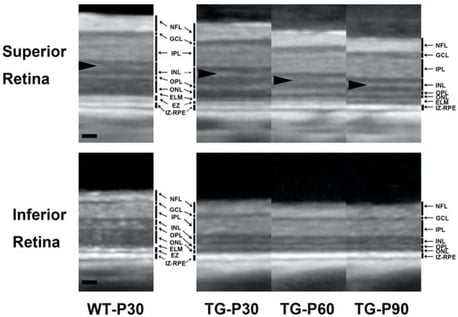 Representative SD-OCT images acquired approximately 4000 µm from the optic nerve head in the superior and inferior retinas in wild-type (WT) and TgP23H (TG) pigs at postnatal day 30 (P30), P60, and P90. Abbreviations: NFL, nerve fiber layer; GCL, ganglion cell layer; IPL, inner plexiform layer; INL, inner nuclear layer; OPL, outer plexiform layer; ONL, outer nuclear layer; ELM, external limiting membrane; EZ, ellipsoid zone; IZ-RPE, interdigitation zone–retinal pigment epithelium. Note the hyperreflective band in the INL (arrowheads), which correlates with abundant mitochondria in horizontal cell processes and adjacent bipolar cells [6,7]. Scale bar: 50 microns.