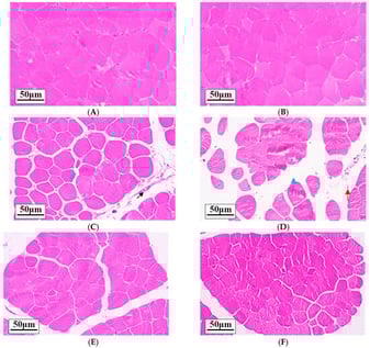 Effects of activating PPARα in vivo on breast muscle histomorphology of broilers under heat stress (×200, n = 12); (A) 28 d TN group; (B) 35 d TN group; (C) 28 d HS group; (D) 35 d HS group; (E) 28 d HSA group; (F) 35 d HSA group. Black arrow: blood vessel. Blue arrow: the intermuscular space widens. Red arrow: inflammatory cells are diffusely distributed. Abbreviation: TN: the thermal neutral group; HS: the heat stress group; HSA: the heat stress with PPARα activation group.
