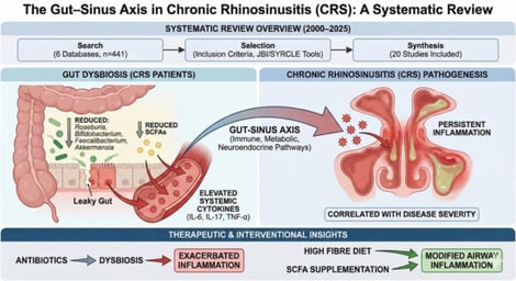 The schematic illustrates proposed immune, metabolic, and neuroimmune mechanisms linking gut microbiome dysbiosis to sinonasal inflammation. GPCR: G-protein-coupled receptors, GPR: G-protein receptors, SCFA: short-chain fatty acids, Th: T helper cells, Treg: T regulatory cells, IL: interleukin, TNF: tumour necrosis factor, TLRs: Toll-like receptors, GABA: Gamma Aminobutyric Acid, CRS: chronic rhinosinusitis, CRSwNP: chronic rhinosinusitis with nasal polyposis, CRSsNP: chronic rhinosinusitis without nasal polyposis, eCRS: eosinophilic chronic rhinosinusitis.