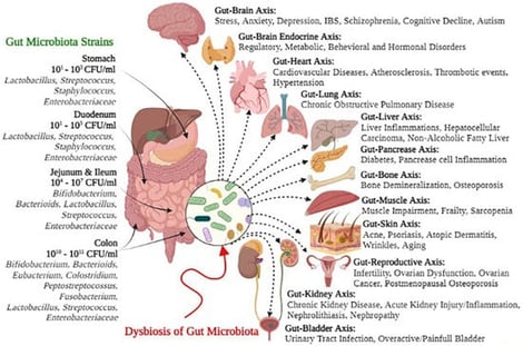 Gut microbial strains and adverse health effects associated with gut microbiota dysbiosis (see red arrow in the figure). Reproduced from Afzaal et al. [34], under the terms of the Creative Commons Attribution License (CC BY). IBS: irritable bowel syndrome. CFU: colony forming unit.