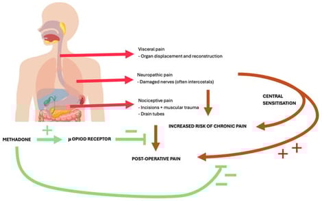 Pathophysiology of pain post-oesophagectomy and effects of methadone. Red arrows describe aetiology of pain post-oesophagectomy. Orange arrows relate this to broader, post-operative pain issues. Green demonstrates the effects of methadone on these pathways, with plus signs indicating an excitatory effect and minus signs indicating an inhibitory effect.