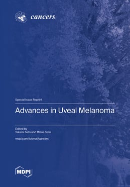 Advances in Uveal Melanoma